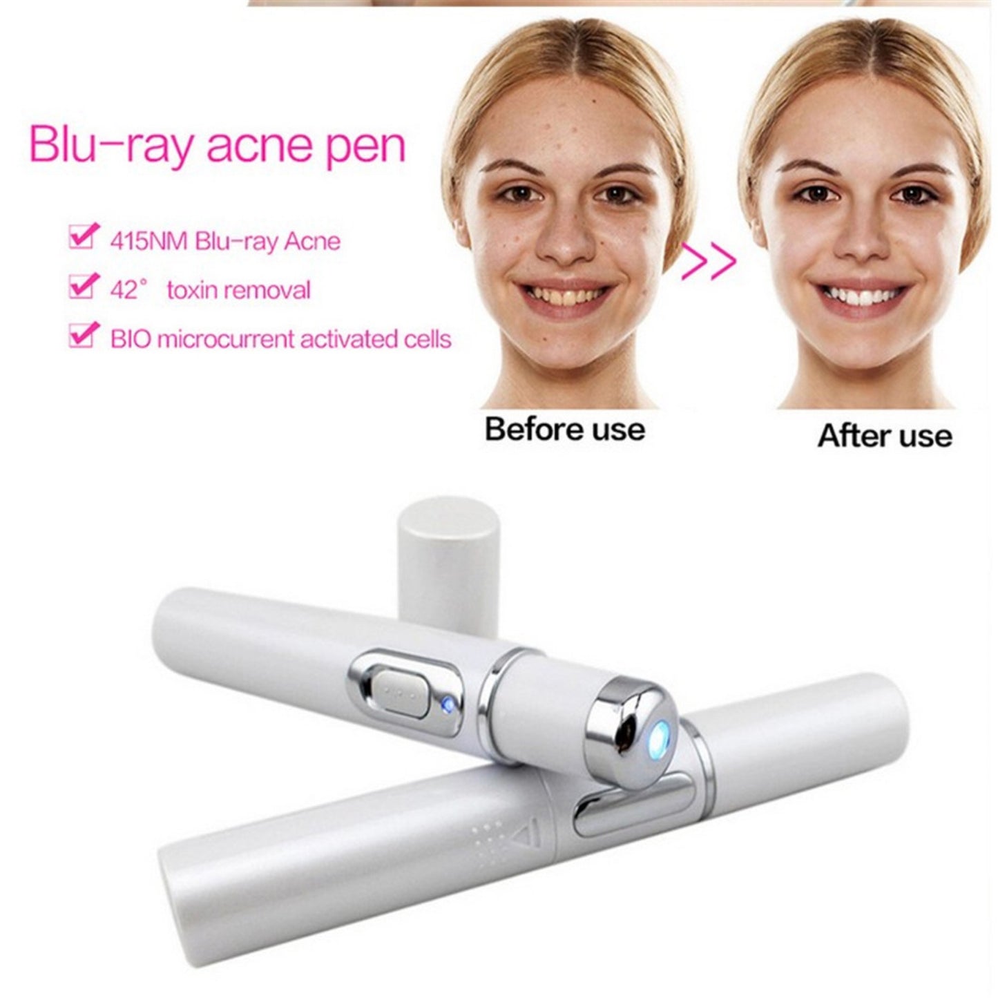 Blue Light Therapy Acne Scar Wrinkle Removal Treatment Device