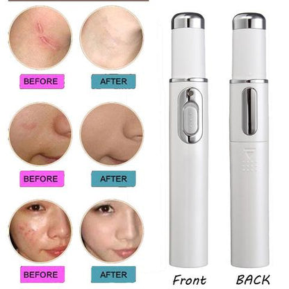 Blue Light Therapy Acne Scar Wrinkle Removal Treatment Device